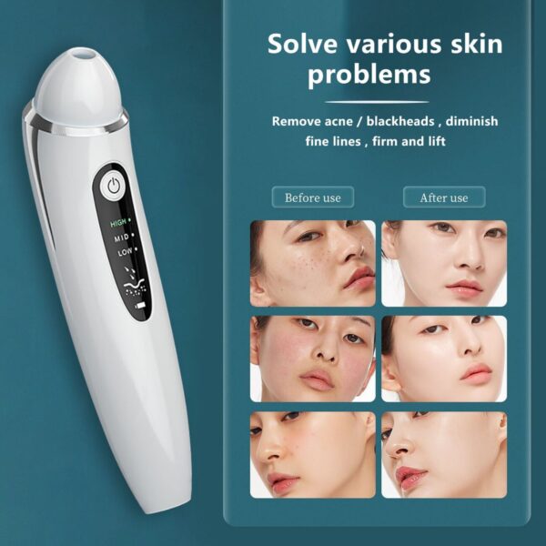 Blackhead Remover Vacuum with Camera price