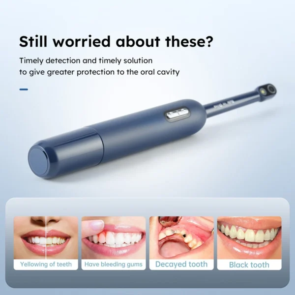 K100 Wireless Intraoral Camera
