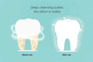 Xiaomi Dr.Bei T1 Ultrasonic Teeth Cleaner - Tartar Remover price